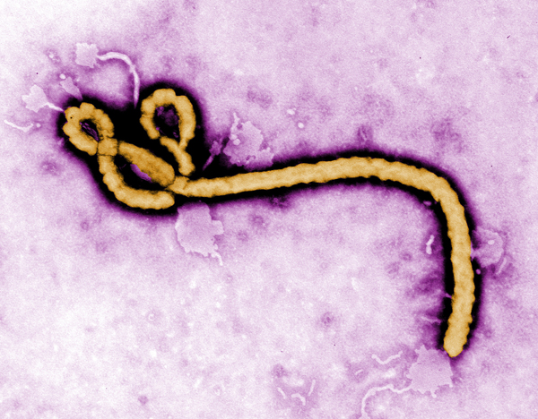 Texas health officials are reassuring residents that they are not at risk of contracting Ebola, unless they had contact with Thomas Duncan, who died on Wednesday at a hospital in Dallas. Photo: CDC Global/Flickr.